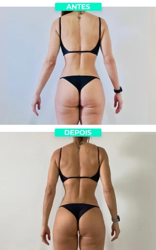 imgi_4_antes_e_depois_3_1