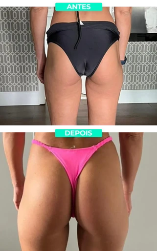imgi_6_antes_e_depois_1_1